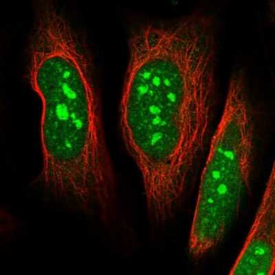Immunocytochemistry/ Immunofluorescence: DDX55 Antibody [NBP2-47490]