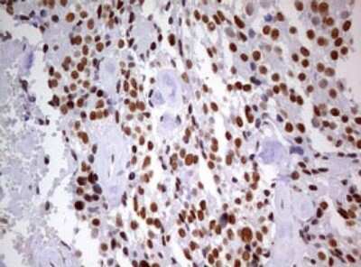 Immunohistochemistry: DDX56 Antibody (OTI2E5) [NBP2-46440]