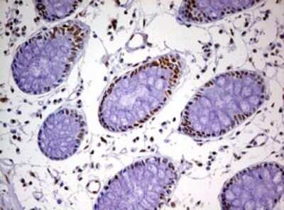 Immunohistochemistry: DDX56 Antibody (OTI2E5) [NBP2-46440]