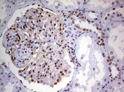 Immunohistochemistry: DDX56 Antibody (OTI2E5) [NBP2-46440]