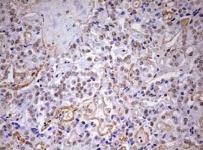 Immunohistochemistry: DDX56 Antibody (OTI2E5) [NBP2-46440]