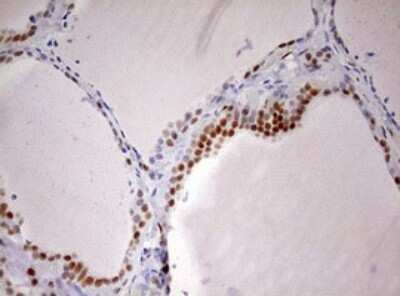 Immunohistochemistry: DDX56 Antibody (OTI2E5) [NBP2-46440]