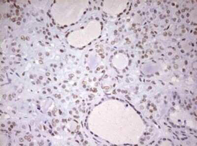 Immunohistochemistry: DDX56 Antibody (OTI2E5) [NBP2-46440]