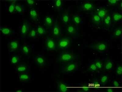 Immunocytochemistry/ Immunofluorescence: DDX56 Antibody (4C5) [H00054606-M05]