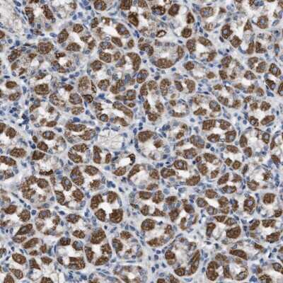 Immunohistochemistry-Paraffin: DDX56 Antibody [NBP1-80990]