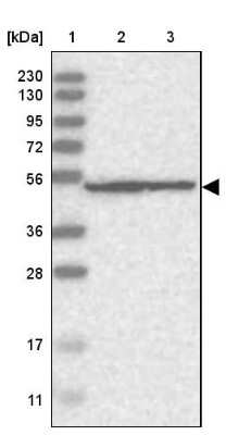 Western Blot: DDX56 Antibody [NBP1-80990]