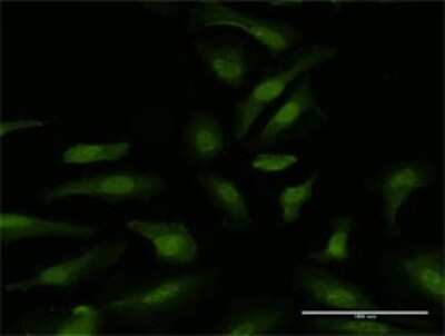 Immunocytochemistry/ Immunofluorescence: DDX6 Antibody [H00001656-D01P]