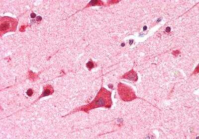 Immunohistochemistry-Paraffin: DDX6 Antibody [NB100-2818]
