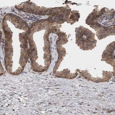 Immunohistochemistry-Paraffin: DDX6 Antibody [NBP1-83249]