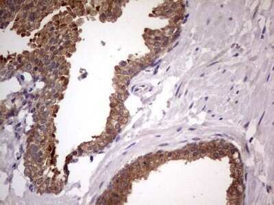 Immunohistochemistry: DDX6 Antibody (OTI2D6) - Azide and BSA Free [NBP2-70563]