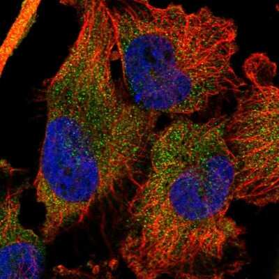 Immunocytochemistry/ Immunofluorescence: DDX60 Antibody [NBP1-91826]