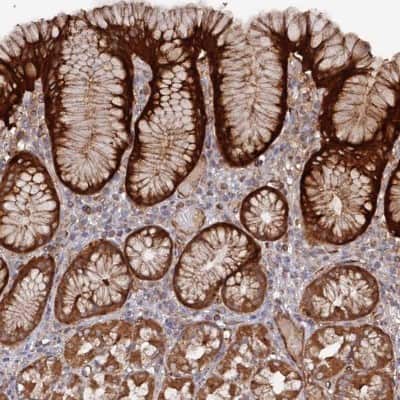 Immunohistochemistry-Paraffin: DDX60 Antibody [NBP1-91826]