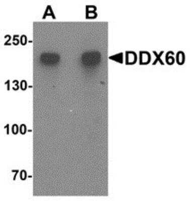 Western Blot: DDX60 AntibodyBSA Free [NBP2-81712]