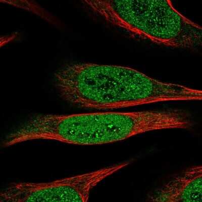 Immunocytochemistry/ Immunofluorescence: DEAF1 Antibody [NBP2-47489]