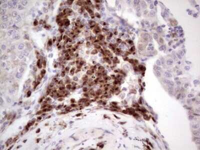 Immunohistochemistry: DEC2/SHARP1 Antibody (OTI5B1) [NBP2-46574]