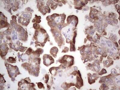 Immunohistochemistry: DEC2/SHARP1 Antibody (OTI5B1) [NBP2-46574]