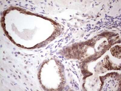 Immunohistochemistry: DEC2/SHARP1 Antibody (OTI5B1) [NBP2-46574]