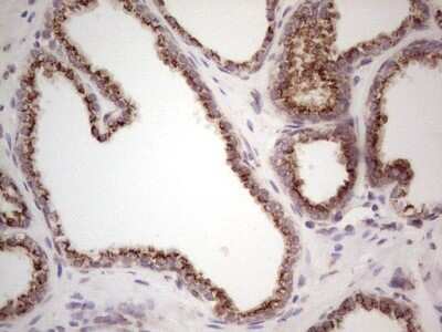 Immunohistochemistry: DEC2/SHARP1 Antibody (OTI5B1) - Azide and BSA Free [NBP2-72203]
