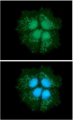 Immunocytochemistry/ Immunofluorescence: DECR1 Antibody (3B2) - BSA Free [NBP2-59469]