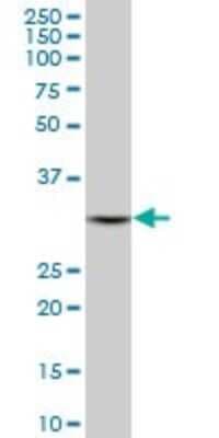 Western Blot: DECR1 Antibody (3D4) [H00001666-M01]