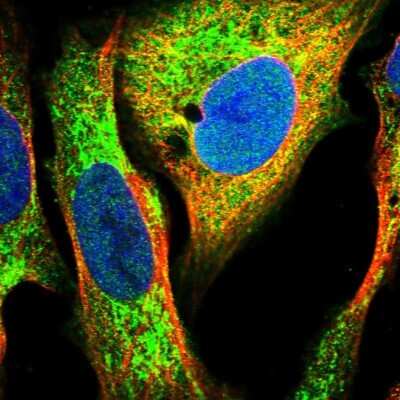 Immunocytochemistry/ Immunofluorescence: DECR1 Antibody [NBP1-85263]