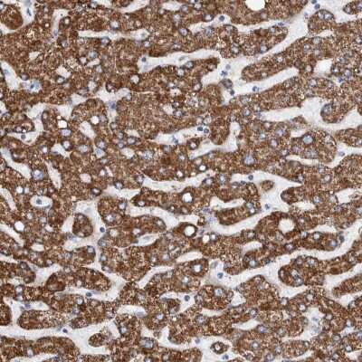 Immunohistochemistry-Paraffin: DECR1 Antibody [NBP1-85264]