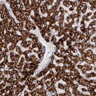 Immunohistochemistry-Paraffin: DECR1 Antibody [NBP1-85265]