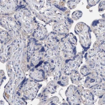 Immunohistochemistry-Paraffin: DECR1 Antibody [NBP1-85265]