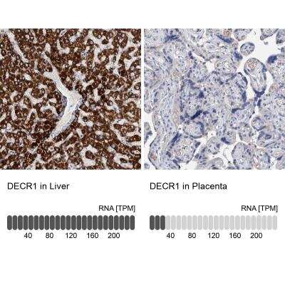 Immunohistochemistry-Paraffin: DECR1 Antibody [NBP1-85265]