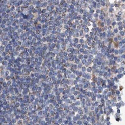 Immunohistochemistry-Paraffin: DECR1 Antibody [NBP1-85265]