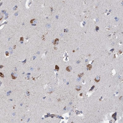 Immunohistochemistry-Paraffin: DECR1 Antibody [NBP1-85265]
