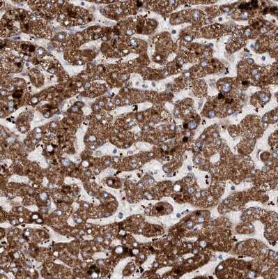 Immunohistochemistry-Paraffin: DECR1 Antibody [NBP1-85265]