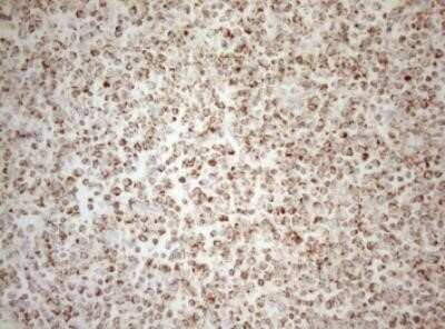 Immunohistochemistry: DECR1 Antibody (OTI4G4) - Azide and BSA Free [NBP2-70564]