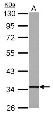 Western Blot: DECR1 Antibody [NBP2-16144]