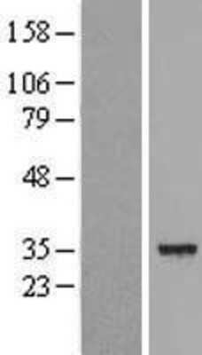 Western Blot: DECR1 Overexpression Lysate [NBL1-09812]