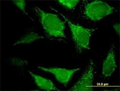 Immunocytochemistry/ Immunofluorescence: DECR2 Antibody (4A7) [H00026063-M03]