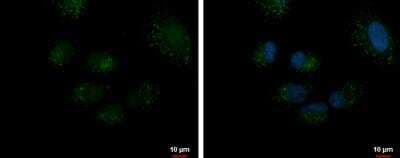 Immunocytochemistry/ Immunofluorescence: DECR2 Antibody [NBP2-16145]