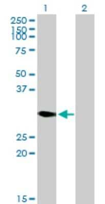 Western Blot: DECR2 Antibody [H00026063-B01P]