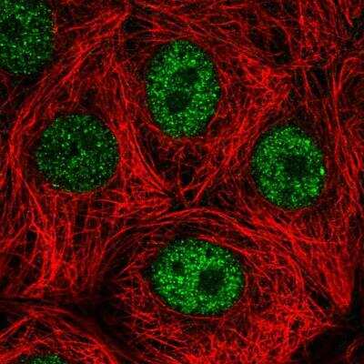 Immunocytochemistry/ Immunofluorescence: DEDD Antibody [NBP2-76527]