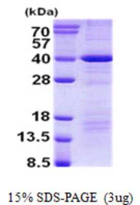 SDS-PAGE: Recombinant Human DEDD His Protein [NBP2-22990]