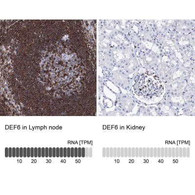 Immunohistochemistry-Paraffin: DEF6 Antibody [NBP1-81618]