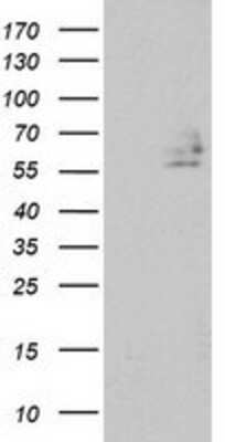 Western Blot: DEF8 Antibody (OTI4B6) [NBP2-00574]