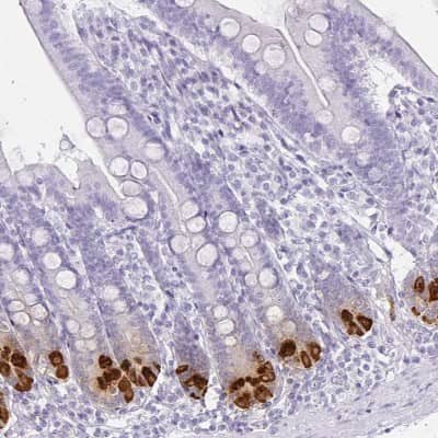 Immunohistochemistry-Paraffin: DEFA6 Antibody [NBP1-84281]