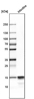 Western Blot: DEFA6 Antibody [NBP1-84281]