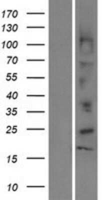 Western Blot: DEFB112 Overexpression Lysate [NBP2-08548]