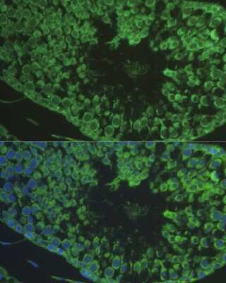 Immunocytochemistry/ Immunofluorescence: DEFB121 Antibody - BSA Free [NBP3-04788]