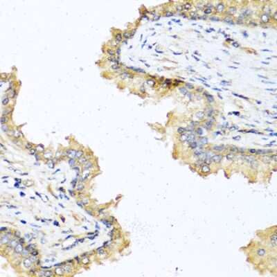 Immunohistochemistry-Paraffin: DEFB121 Antibody - BSA Free [NBP3-04788]