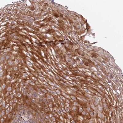 Immunohistochemistry-Paraffin: DEFB125 Antibody [NBP1-90595]