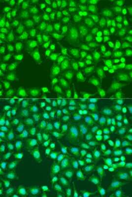 Immunocytochemistry/ Immunofluorescence: DEFB126 Antibody - BSA Free [NBP3-03581]