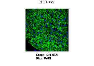 Immunohistochemistry: DEFB129 Antibody [NBP2-82832]